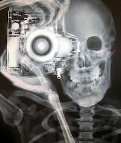 Skeleton-photog