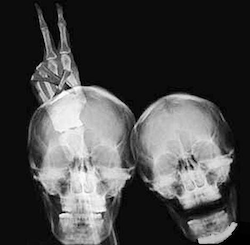 Skeleton-bunny-ears