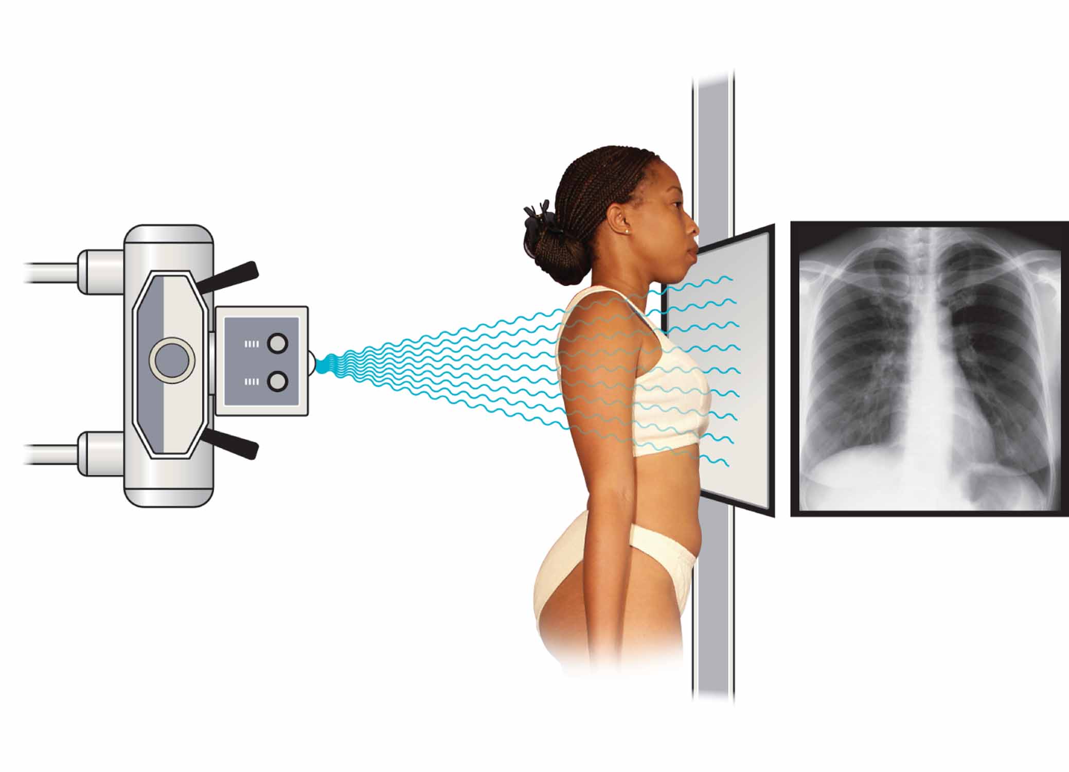 Diagram of a Radiograph capture of a female patient