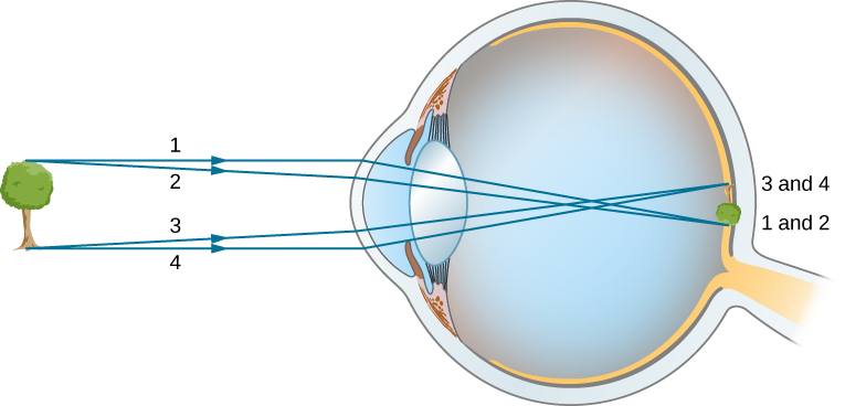 diagram image formation in the eye