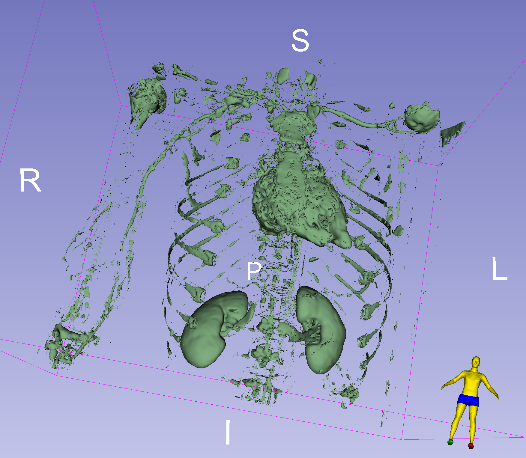 threshold initial result