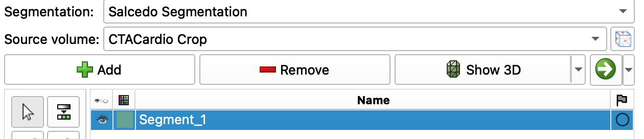 screenshot from slicer of segment editor