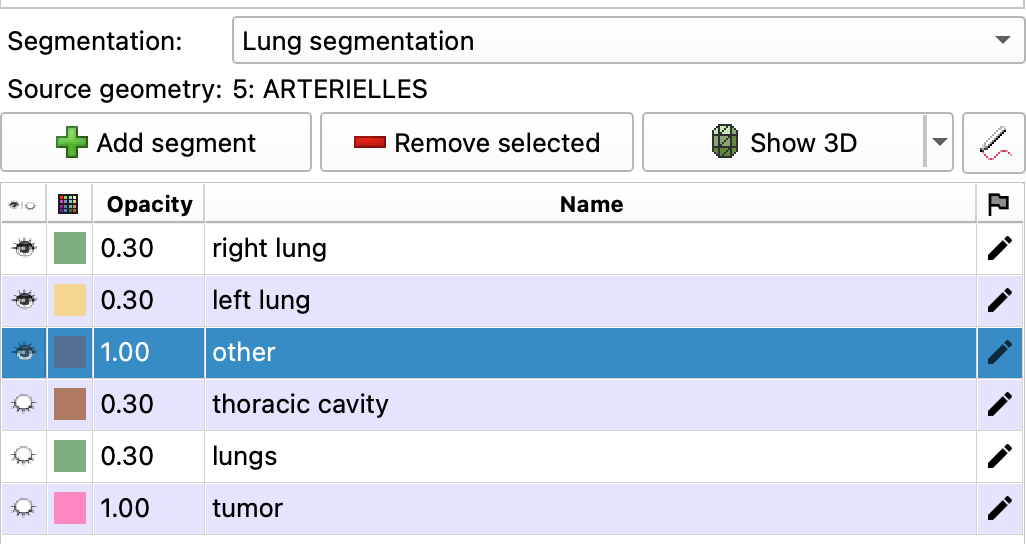 slicer segmentations module