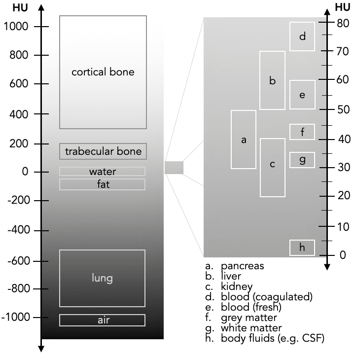 hounsfield scale