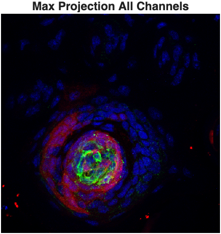 max projection all channels