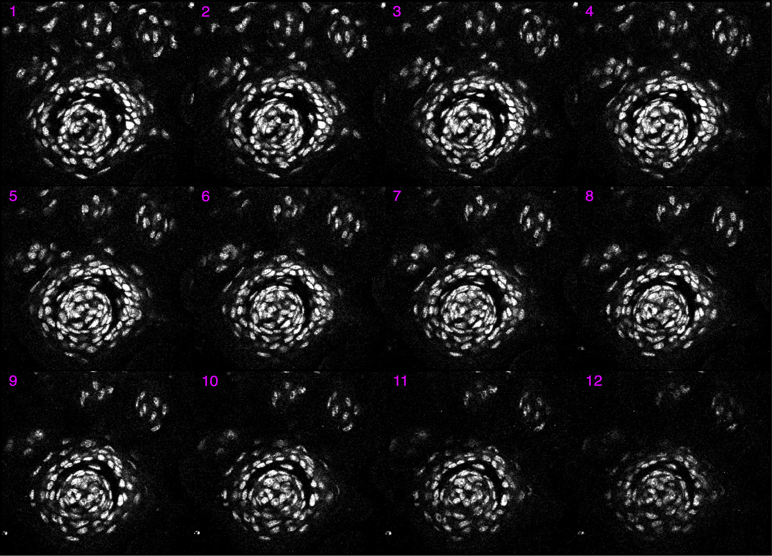 montage of optical slices from the mouse tastebud image stack