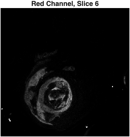 red channel slice 6