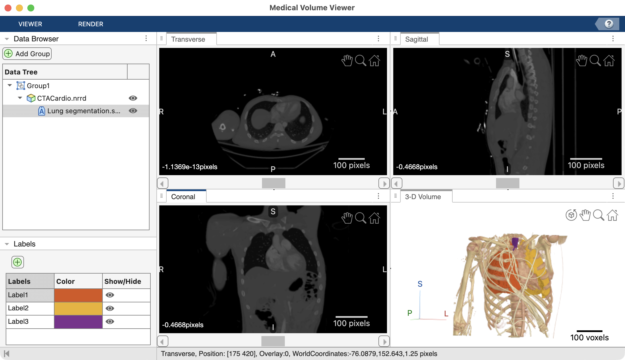 Screen grab of Medical Volume Viewer