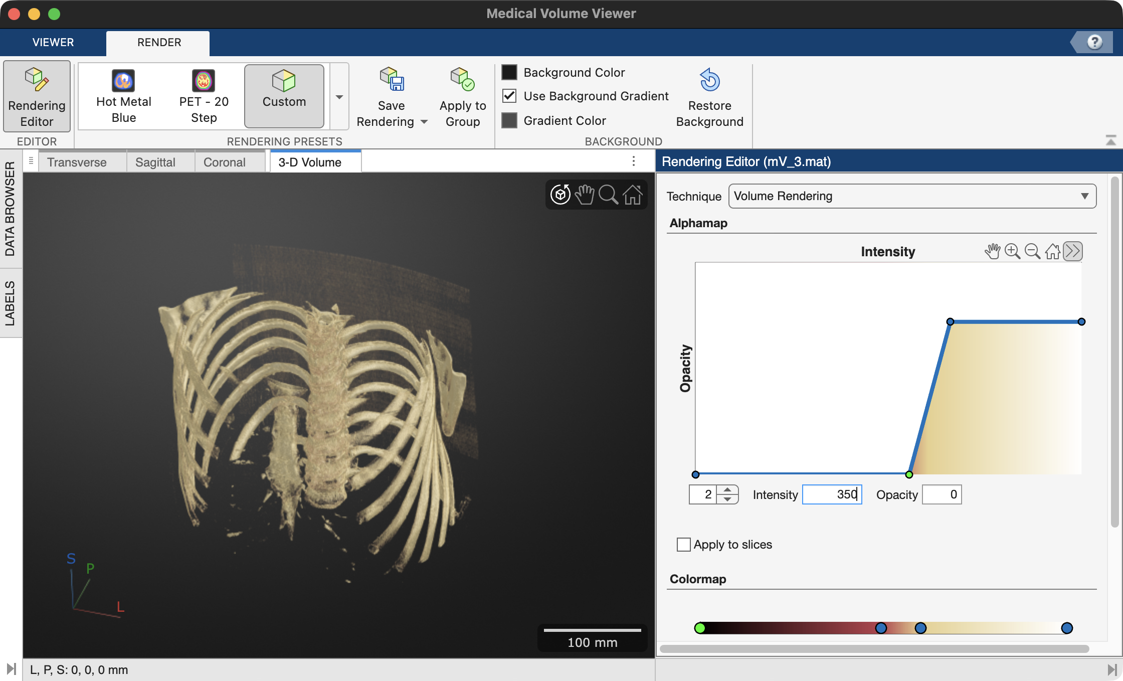 medVolViewer CT Bone focus