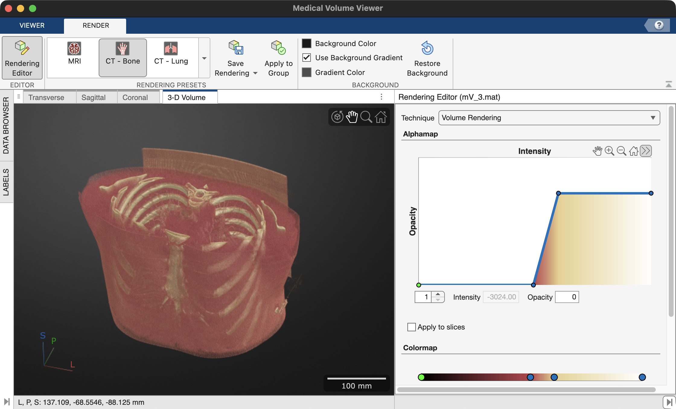 medVolViewer CT Bone preset