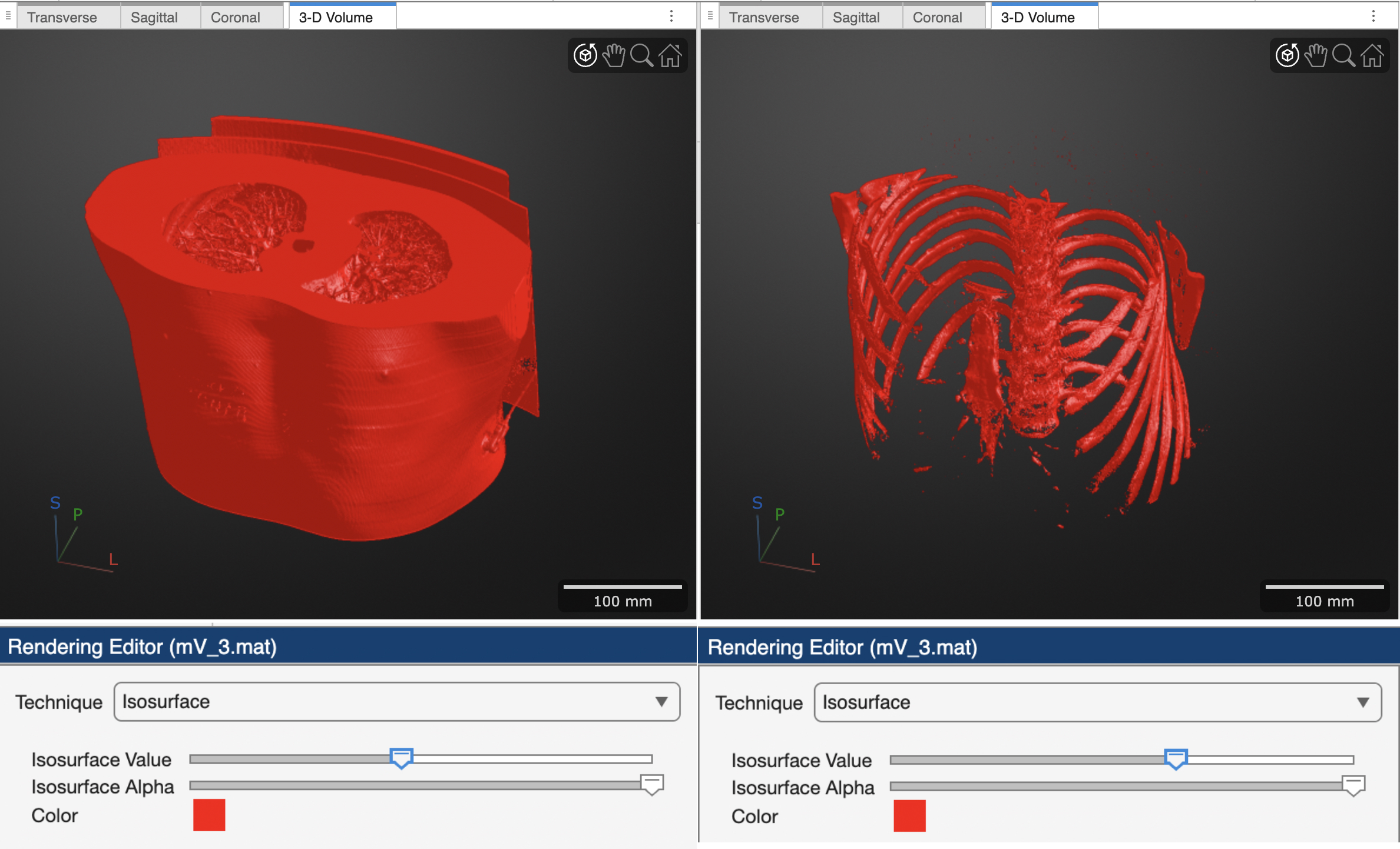 CT lung surface rendering