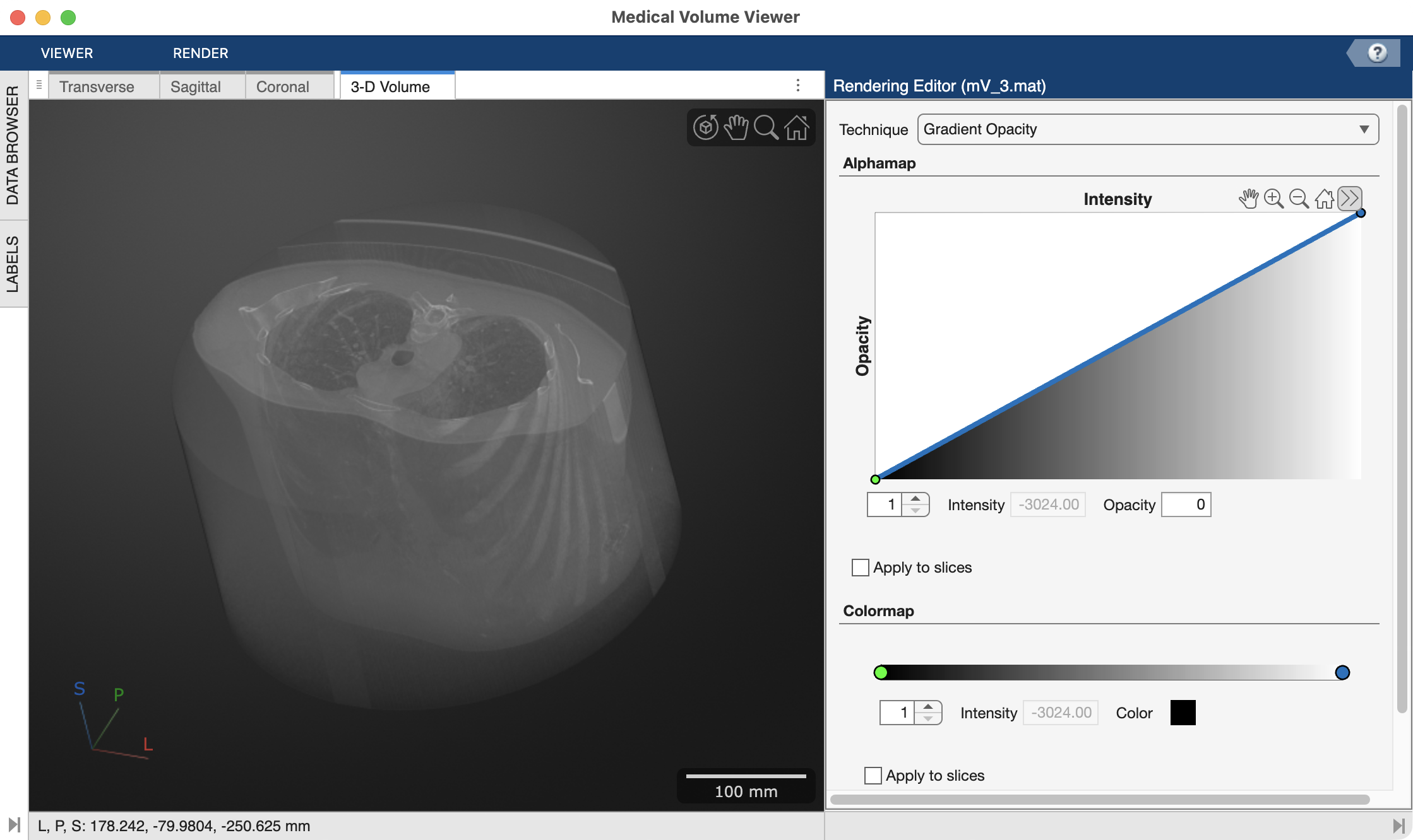 medVolumeViewer lungCT02