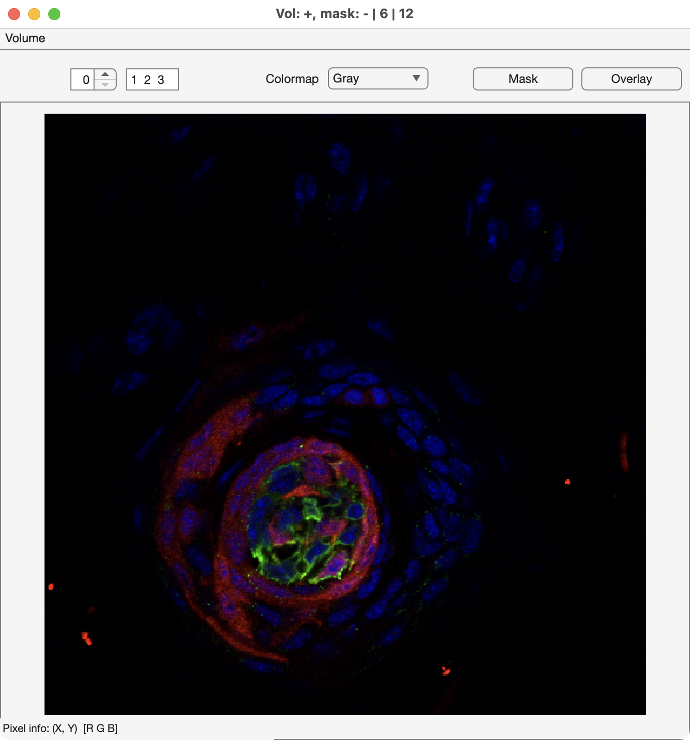 screen grab of mmSliceView