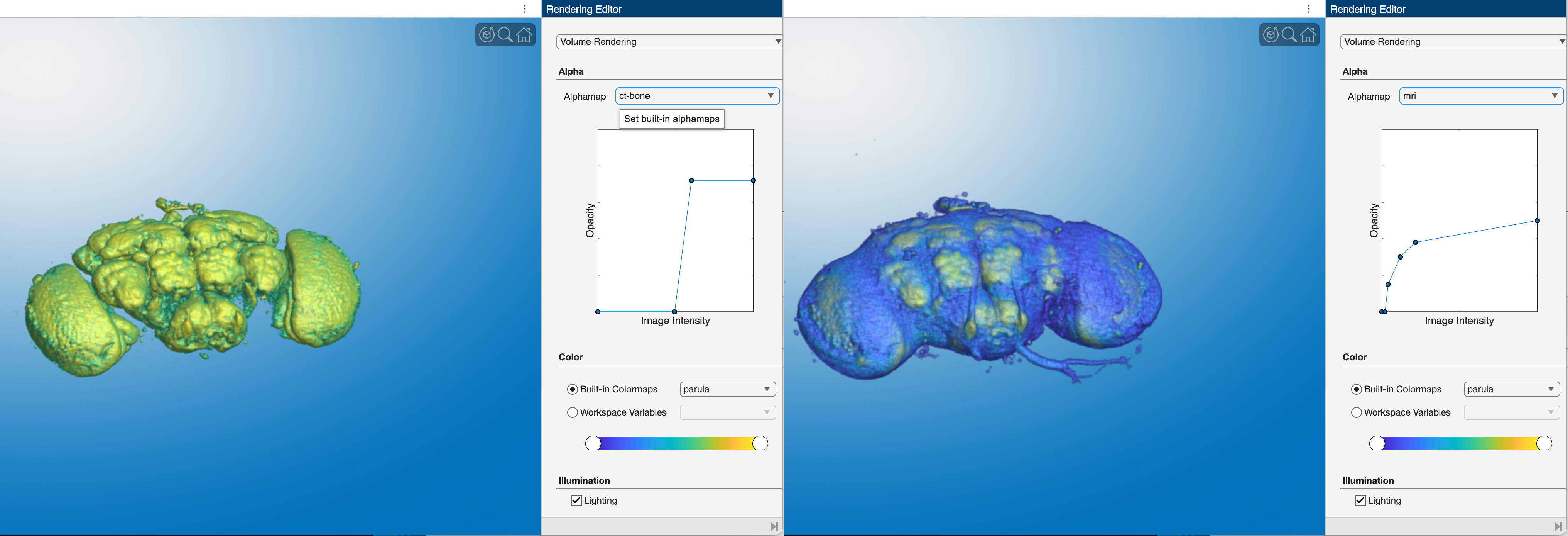 Vol Viewer side by side views of 2 different presets