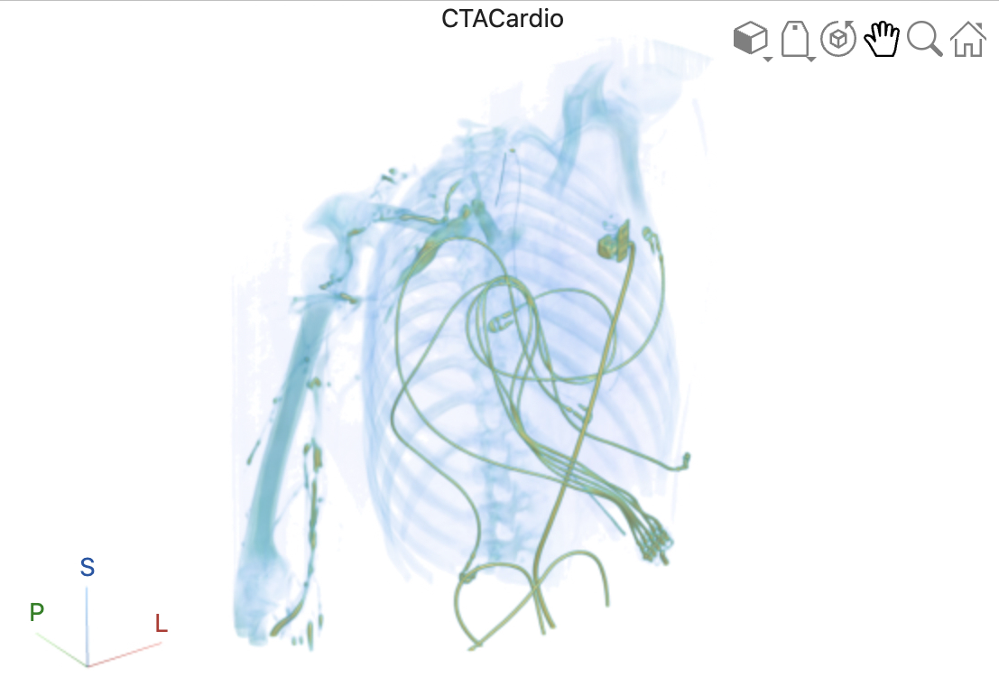 volshow with parula colormap and title