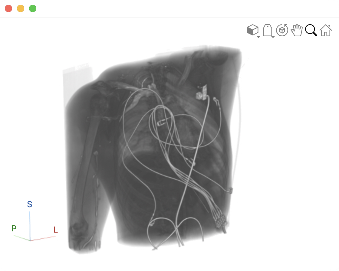 volshow ctacardio crop white background