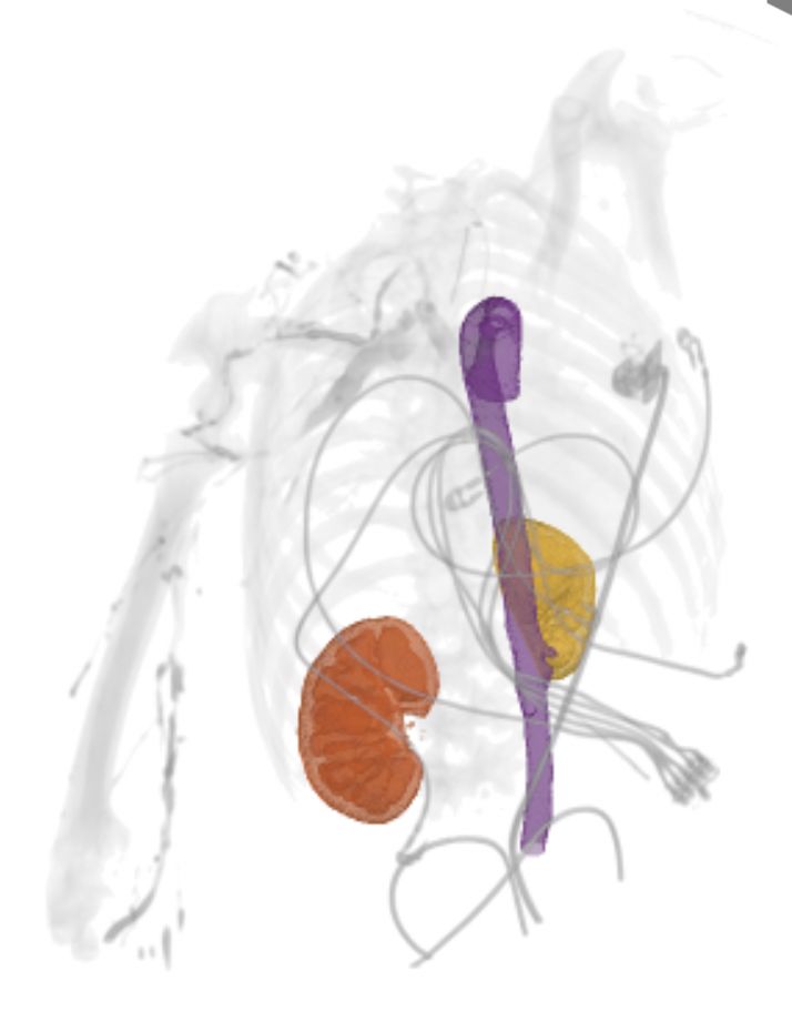 ctacardio with kidneys