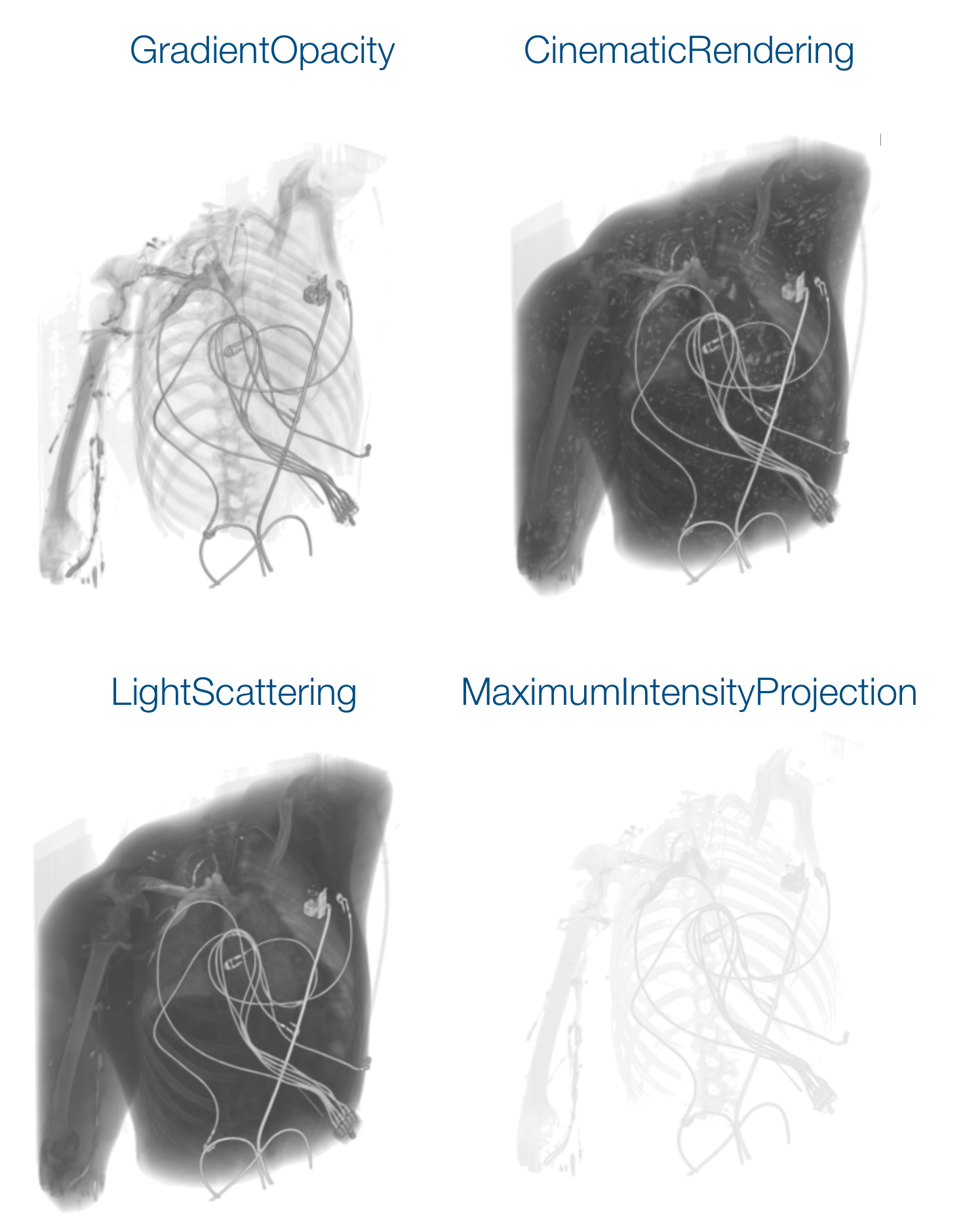 comparison of volshow rendering styles